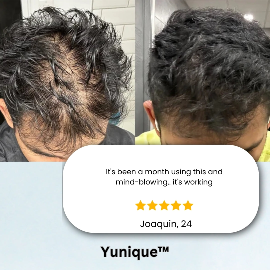 Yunique Follicle Revival™