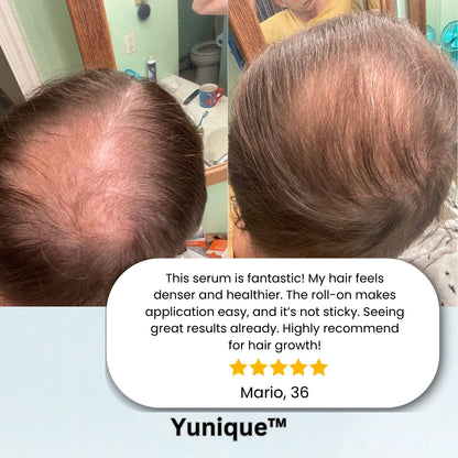 Yunique Follicle Revival™ 